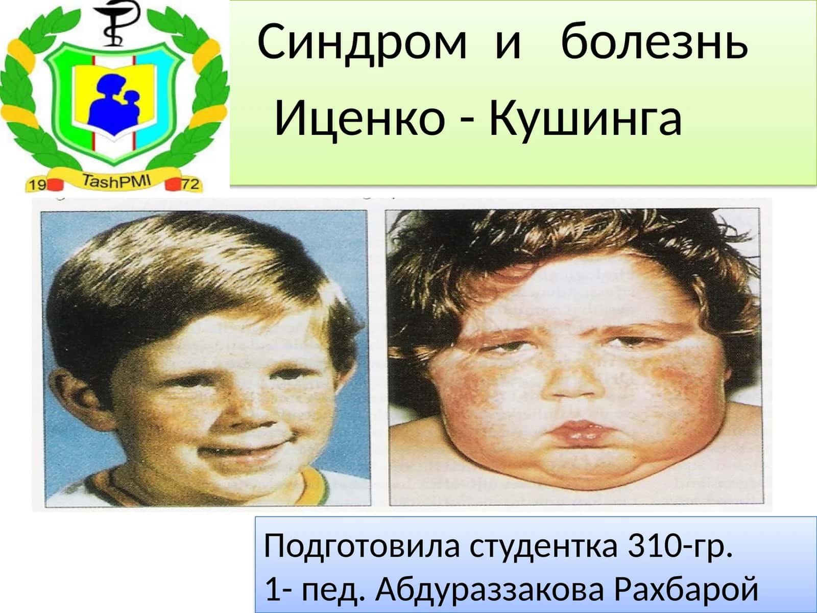 Иценко-Кушинга 1