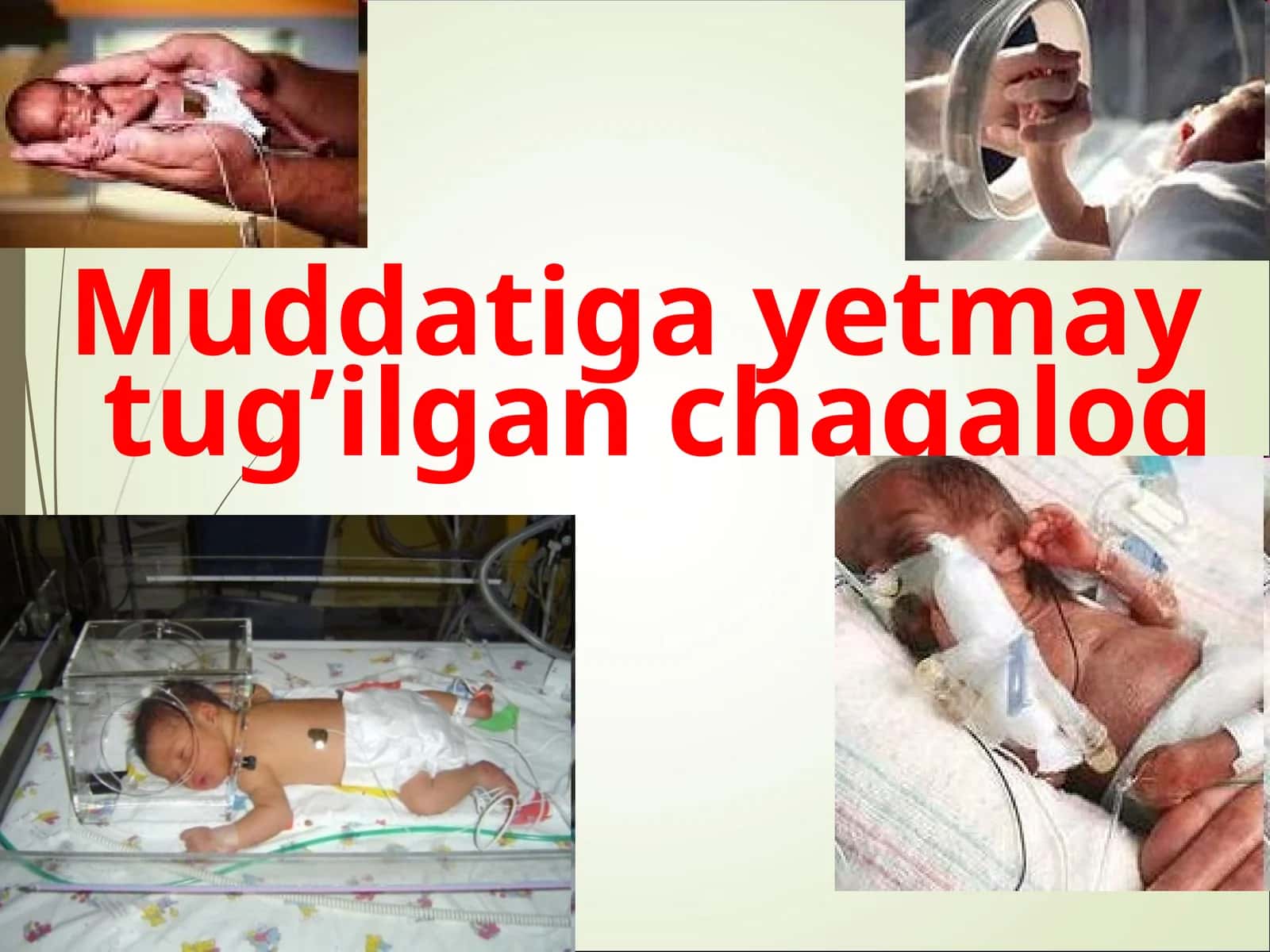 Muddatigayetmay tug’ilgan chaqaloq 1