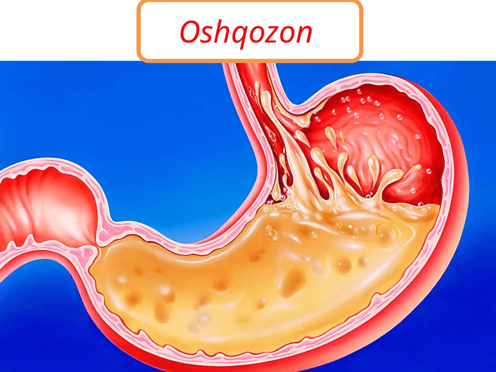 Oshqozon 1