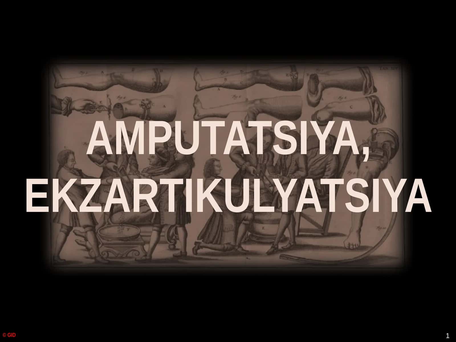 AMPUTATSIYA, EKZARTIKULYATSIYA 1