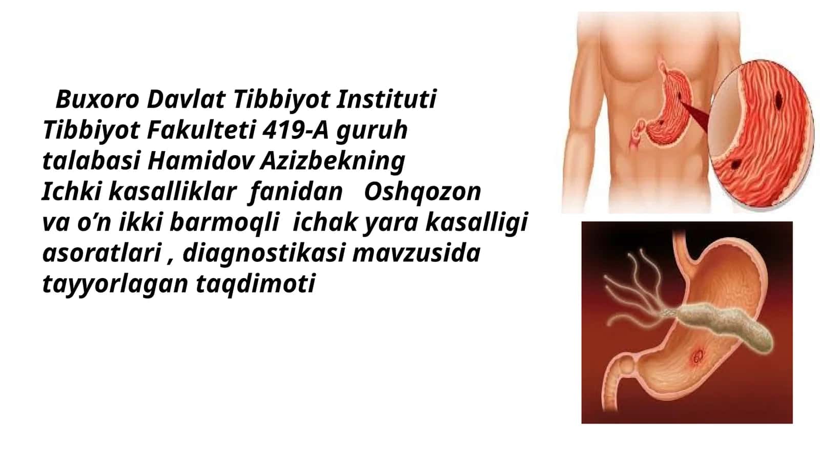 Oshqozon va o‘n ikki barmoqli ichak yara kasalligi 1