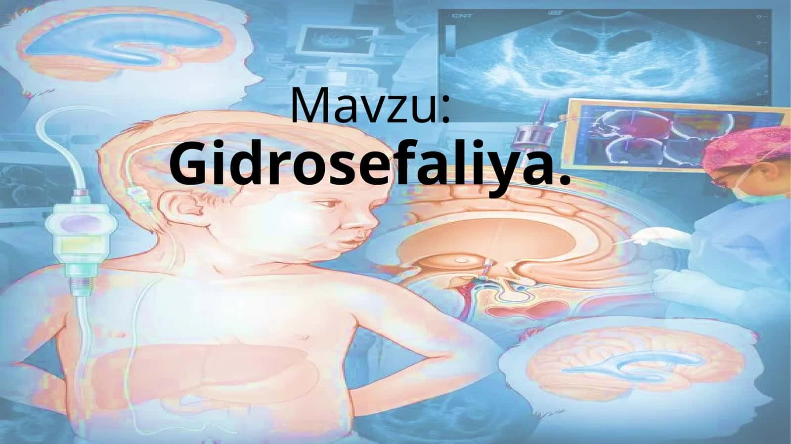 Gidrosefaliya 1