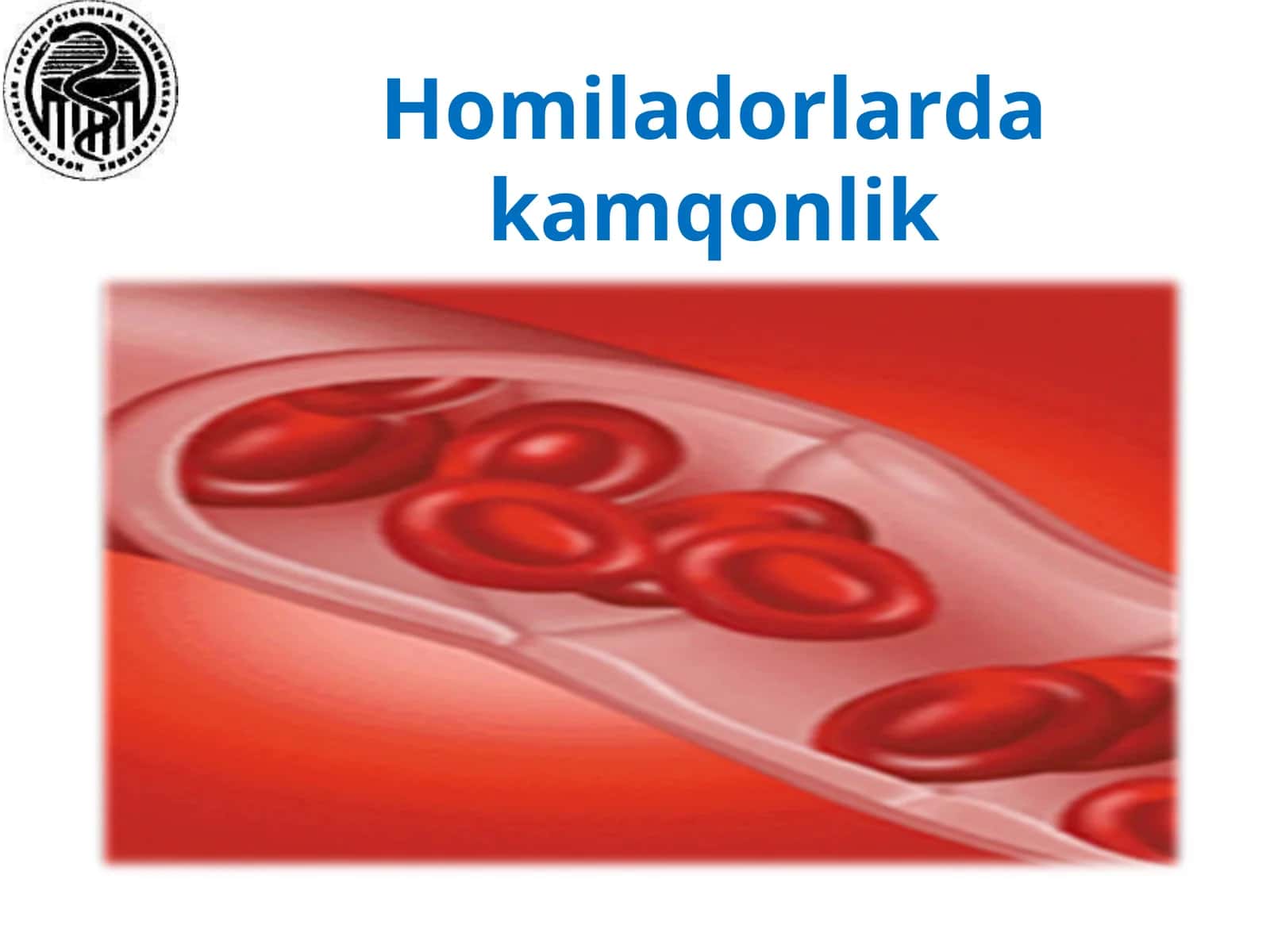 Homiladorlarda kamqonlik 1