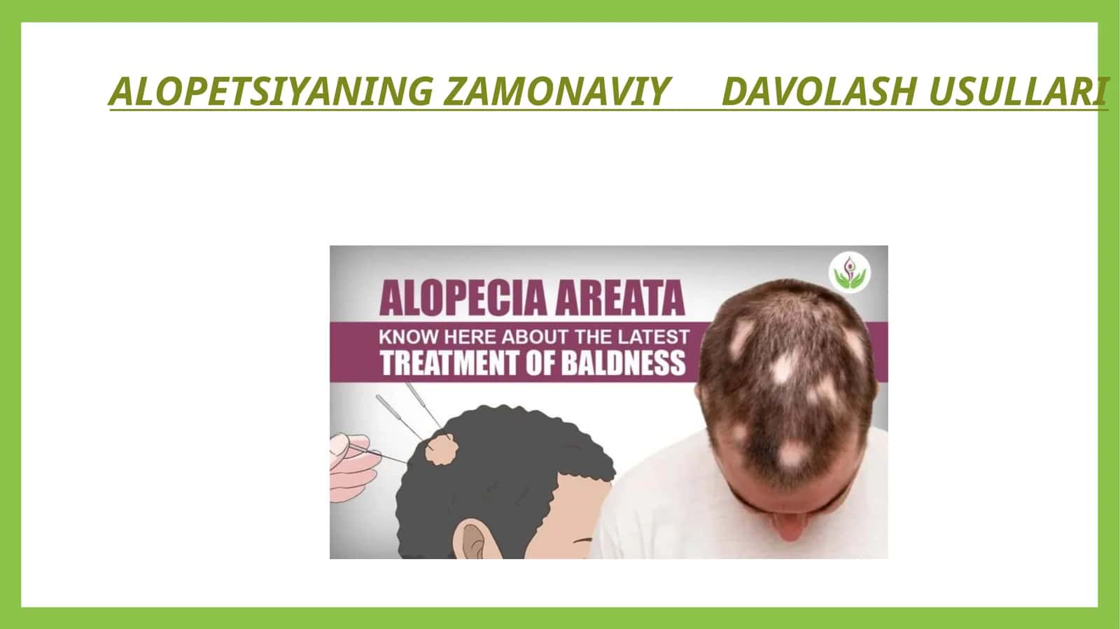 ALOPETSIYANING ZAMONAVIY DAVOLASH USULLARI 1