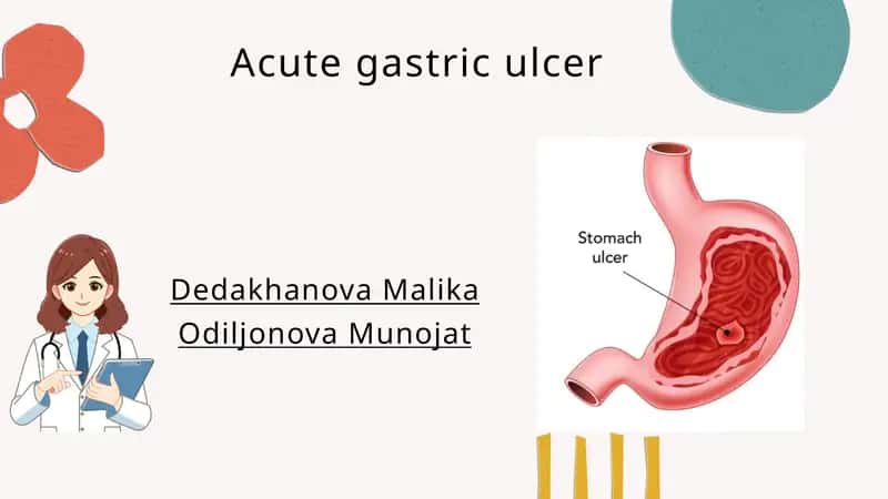 Gastric ulcer 1