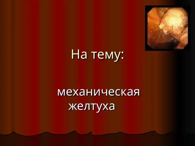 Механическая желтуха 1