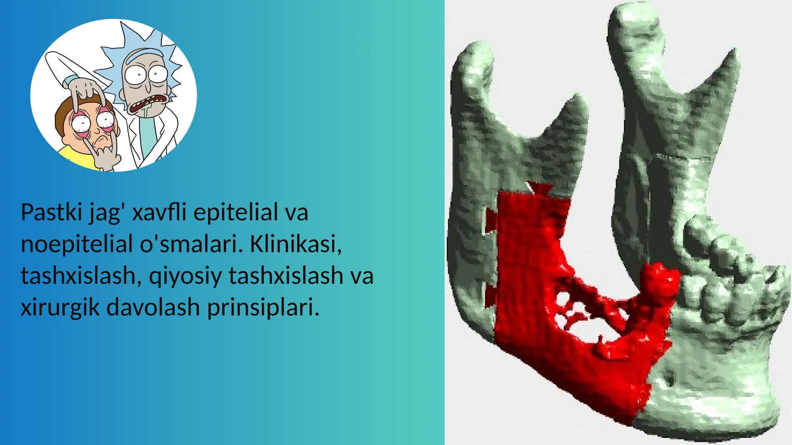 Pastki jag' xavfli epitelial va noepitelial o'smalari 1