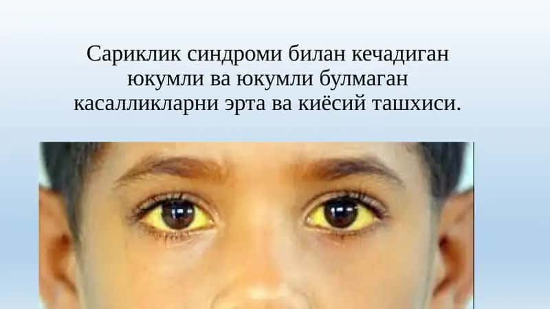 Сариклик синдроми билан кечадиган юкумли ва юкумли булмаган касалликларни эрта ва киёсий ташхиси 1