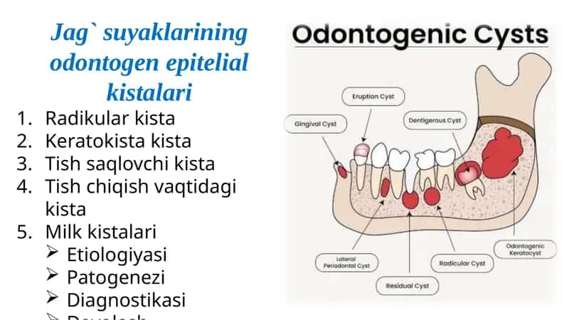 Jag`suyaklarining odontogen epitelial kistalari 1