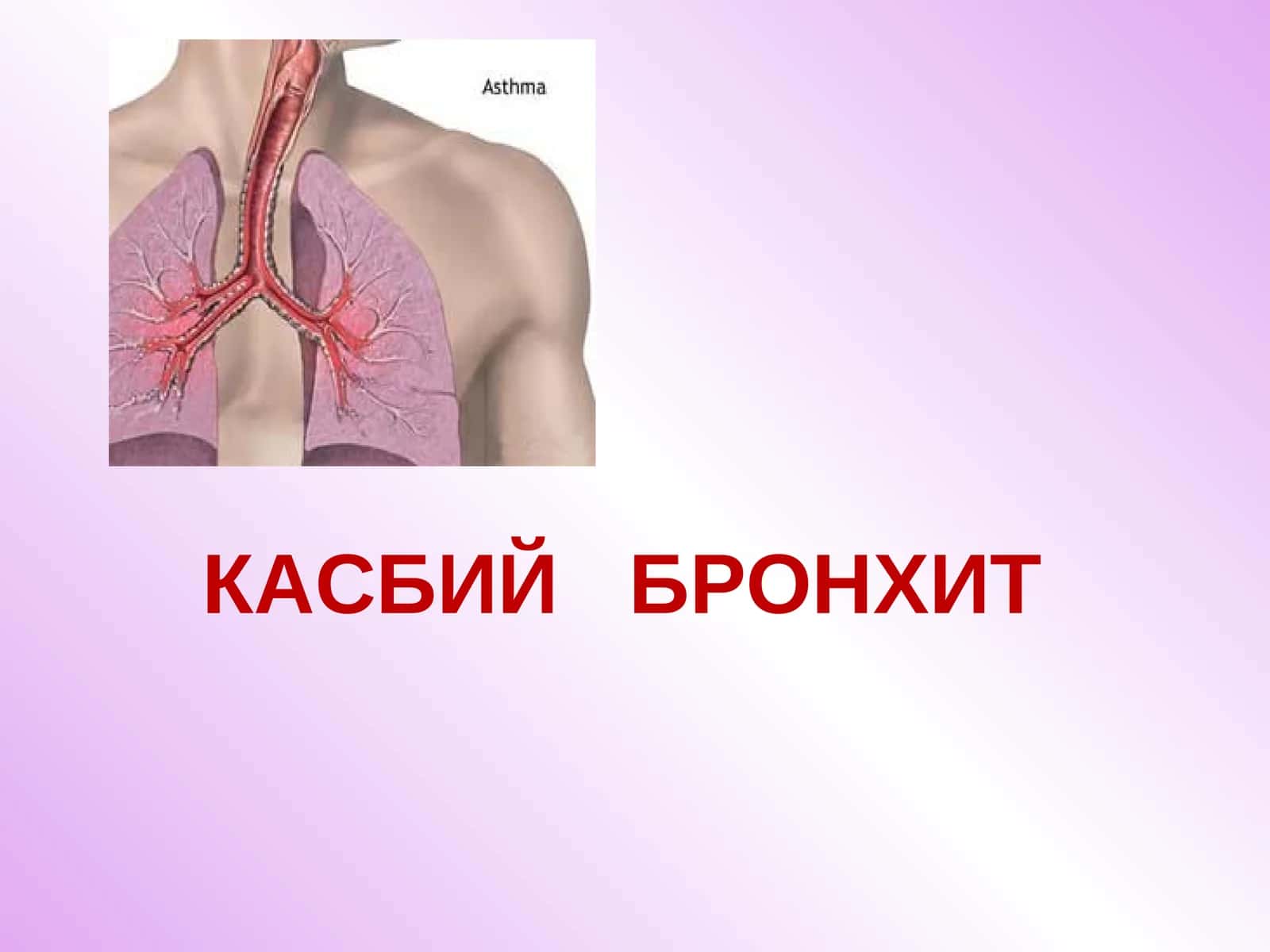 КАСБИЙ БРОНХИТ 1