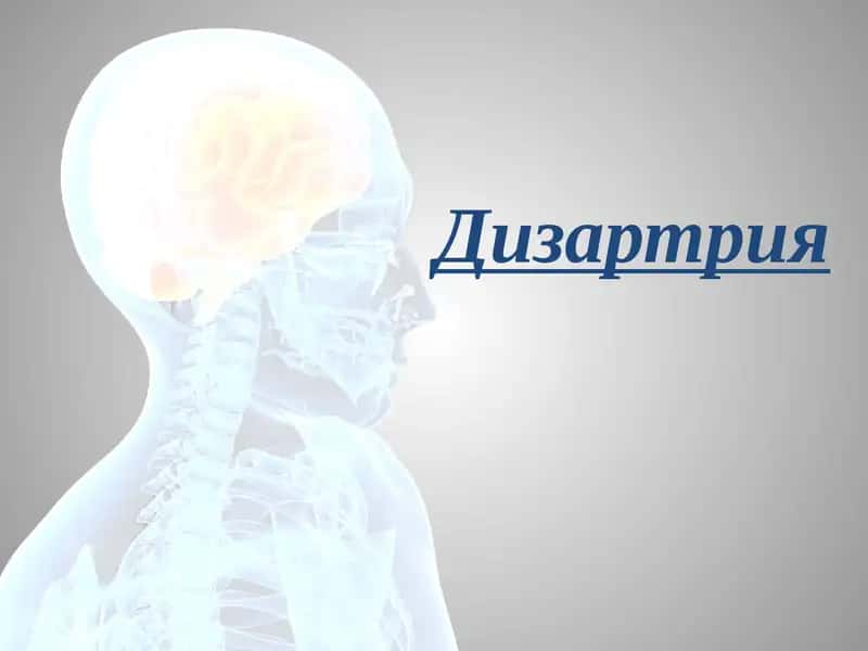 Дизартрия 1