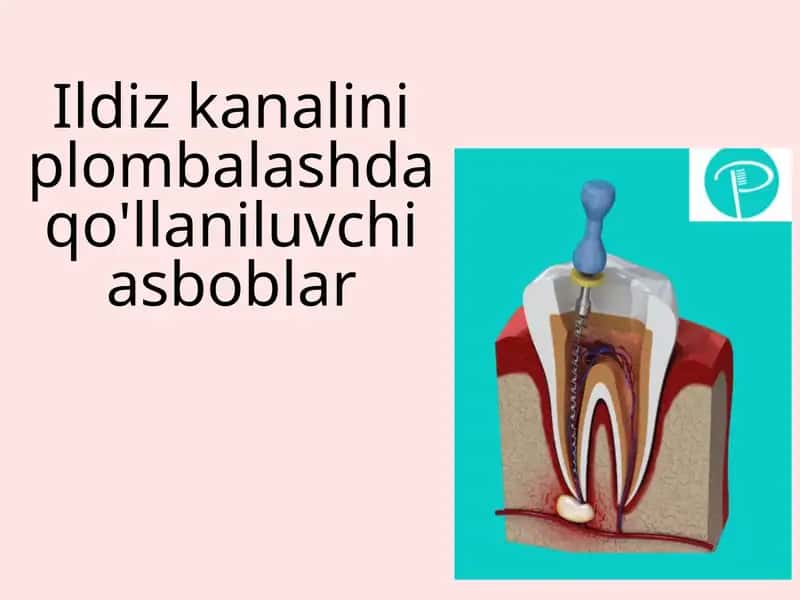 Ildiz kanalini plombalashda qo'llaniluvchi asboblar 1
