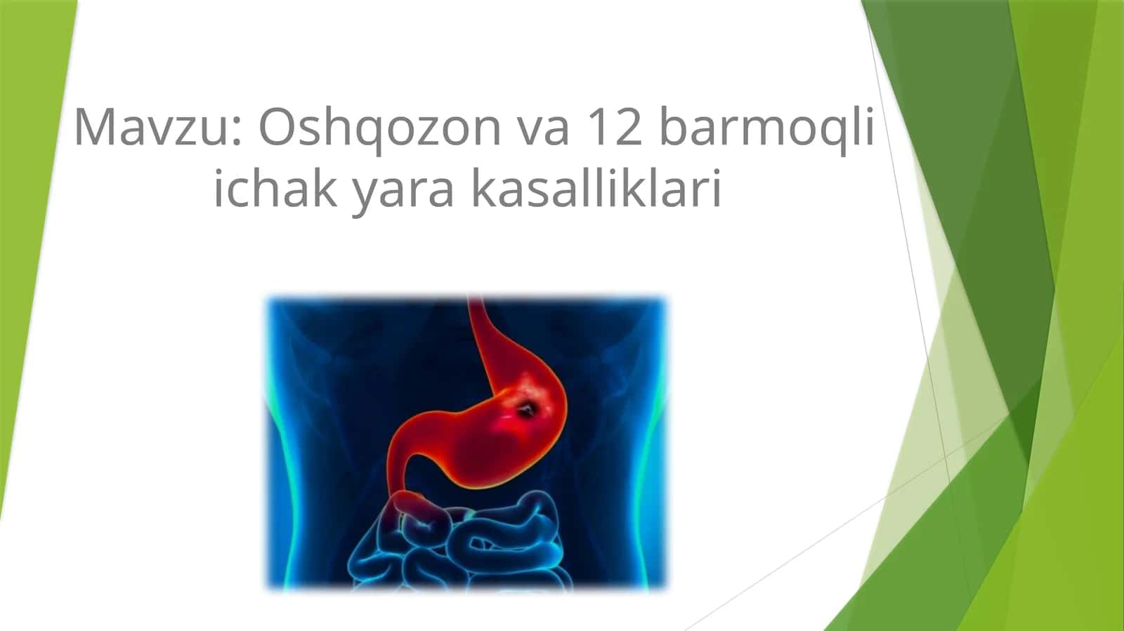 Oshqozon va 12 barmoqli ichak yara kasalliklari 1