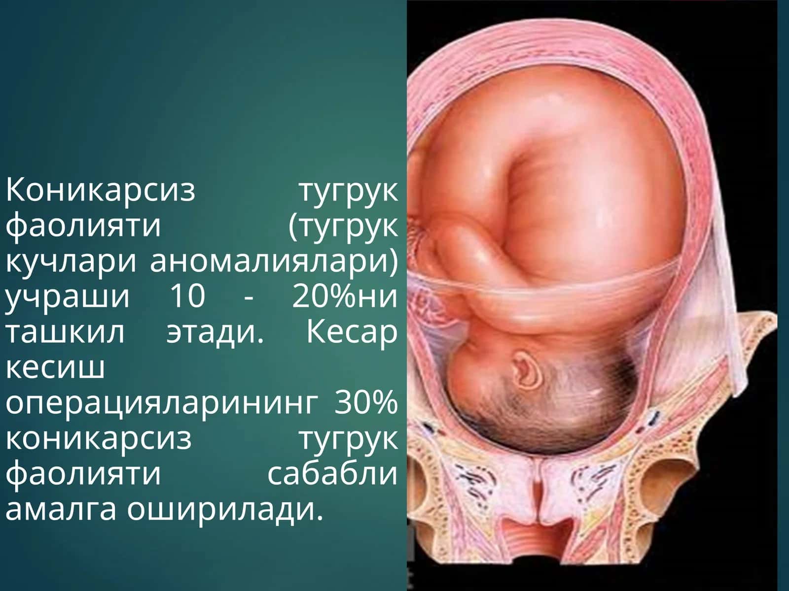 Коникарсиз тугрук фаолияти 1