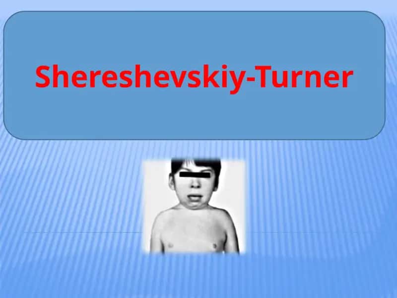 Shereshevskiy-Turner 1