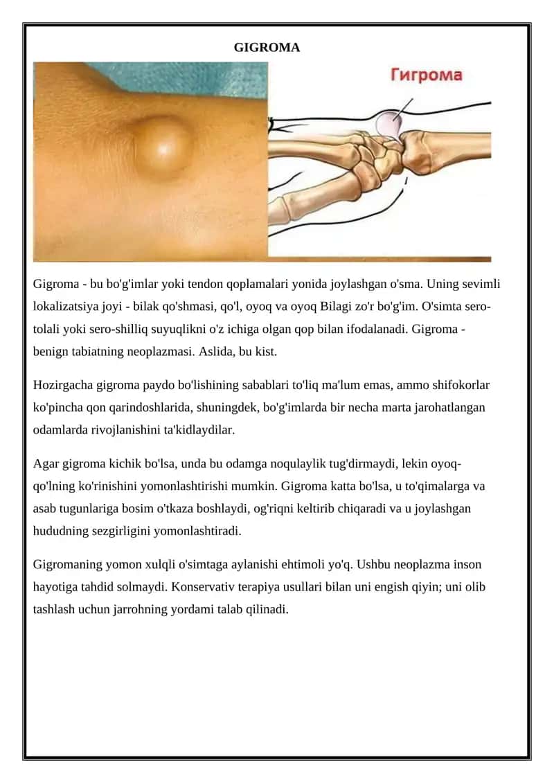 Gigroma 1
