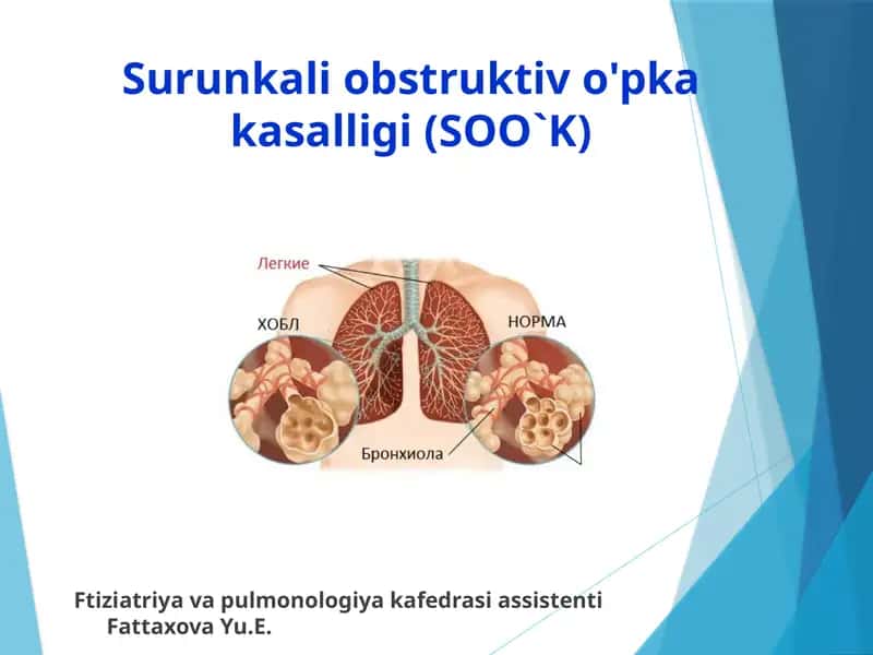 Surunkali obstruktiv o'pka kasalligi(SOO`K) 1