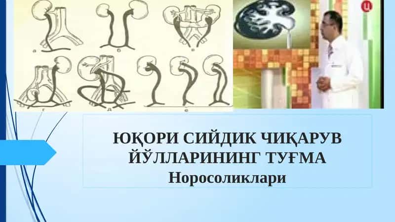 ЮҚОРИ СИЙДИК ЧИҚАРУВ ЙЎЛЛАРИНИНГ ТУҒМАНоросоликлари 1