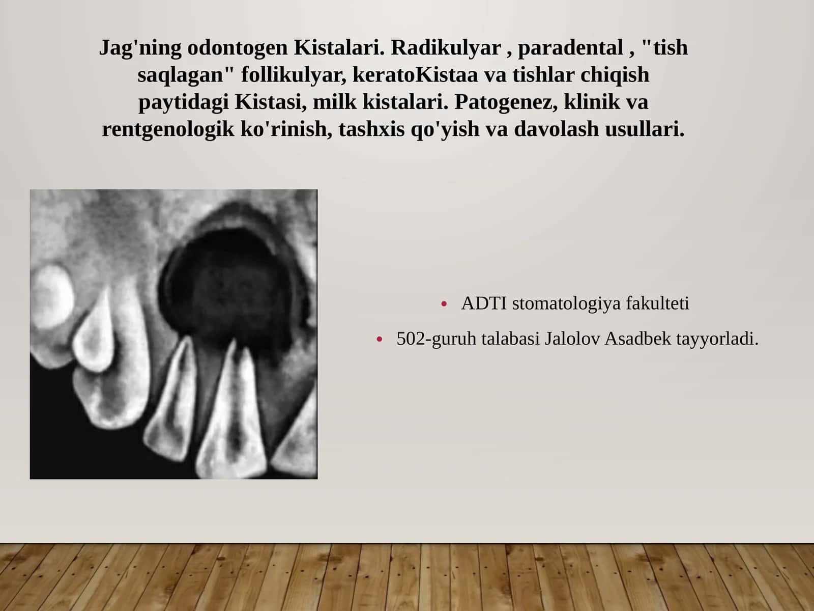 Jag'ning odontogenKistalari 1