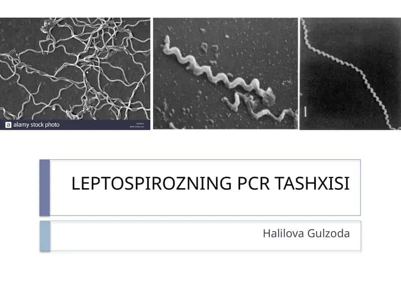 LEPTOSPIROZNING PCR TASHXISI 1