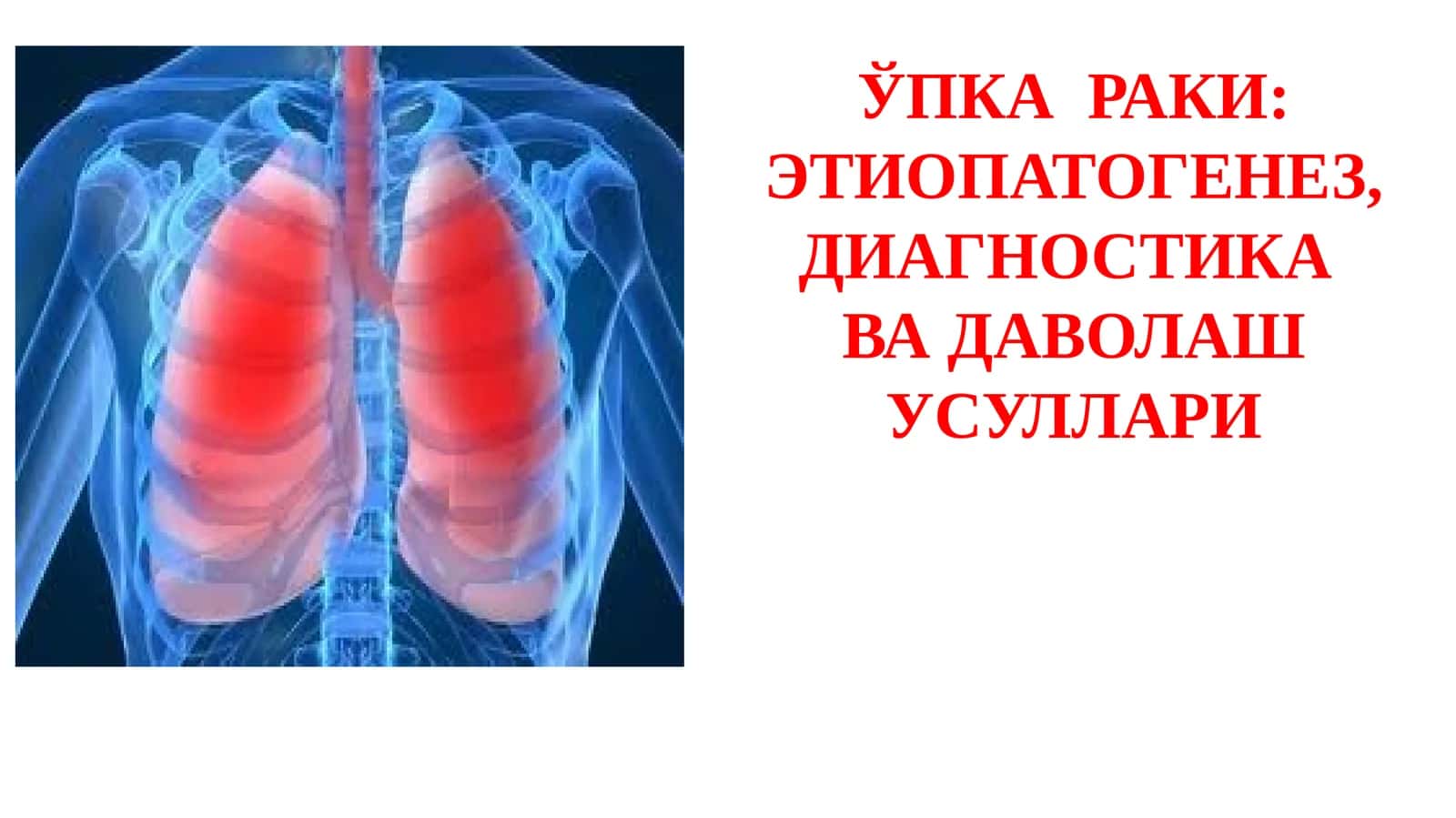 ЎПКА РАКИ 1