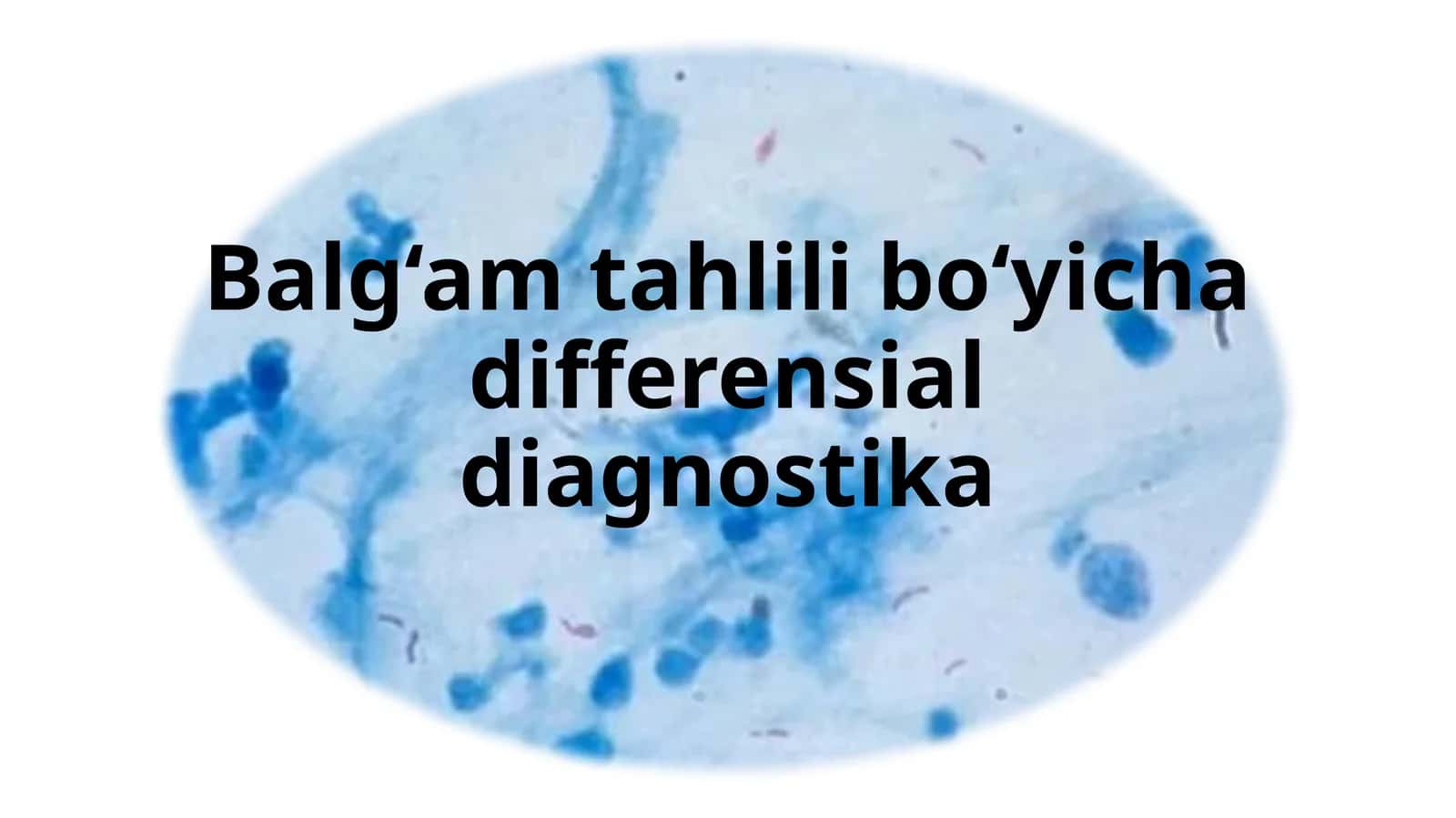 Balg‘am bo‘yicha differensial diagnostika 1