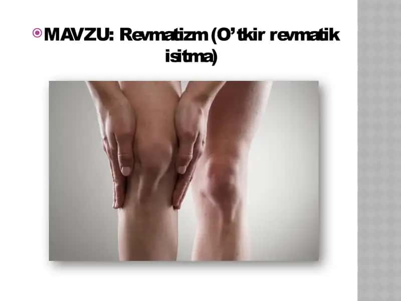 Revmatizm "O’tkir revmatik isitma" 1