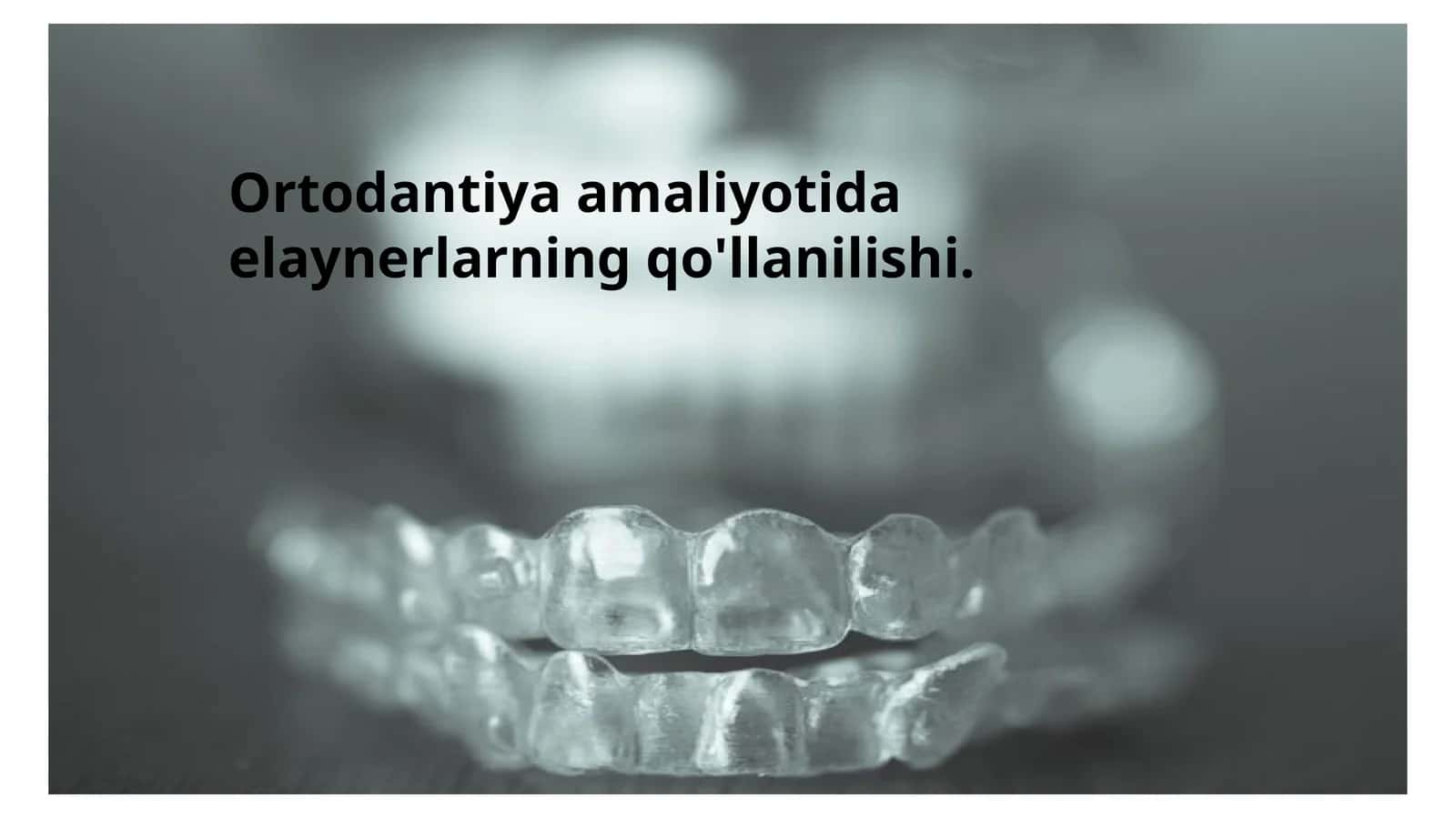 Elaynerlar 1