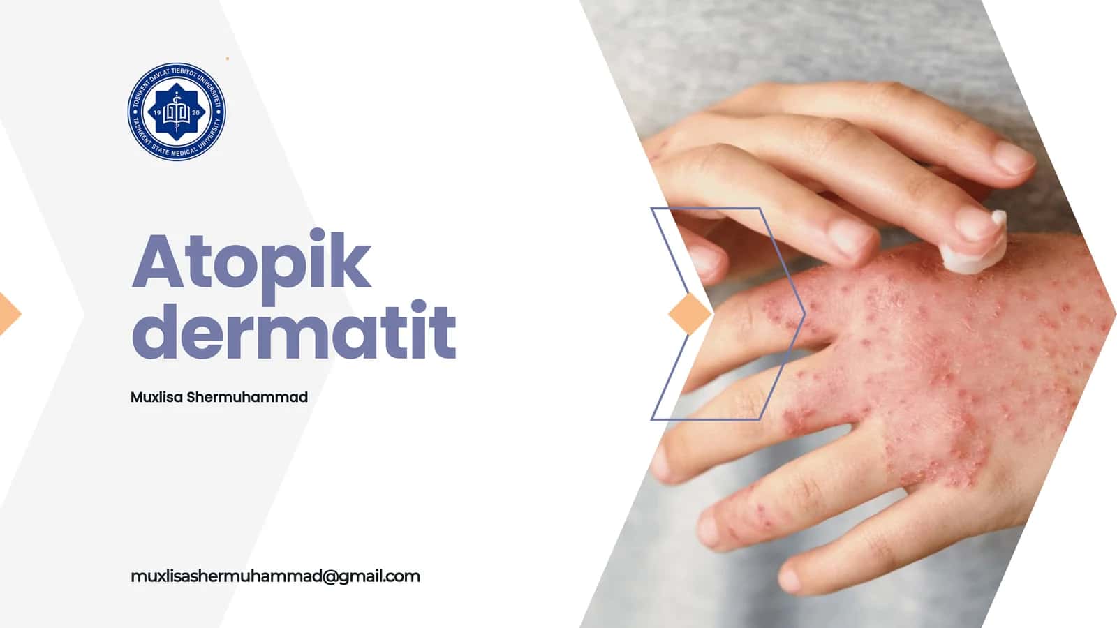 Atopik dermatit 1
