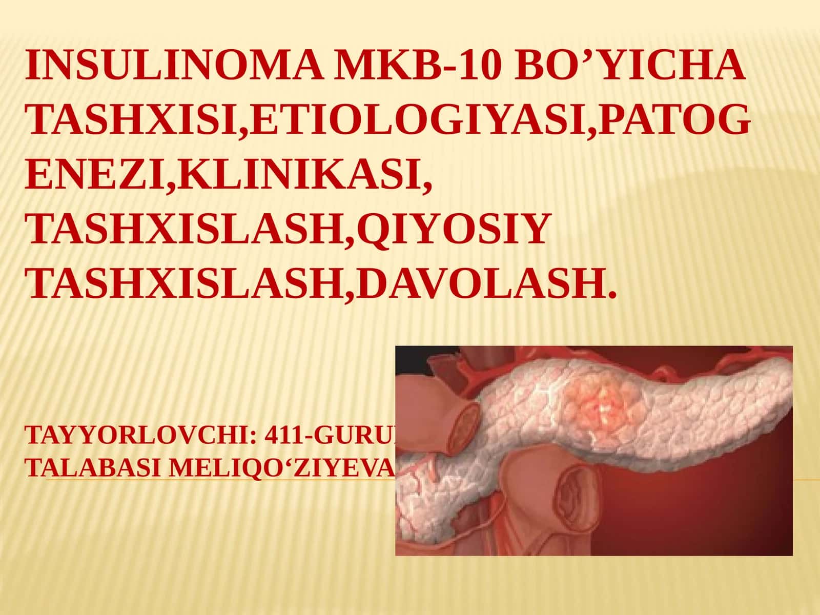 Insulinoma 1
