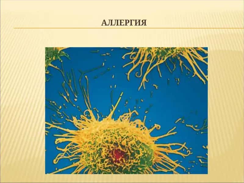 АЛЛЕРГИЯ 1