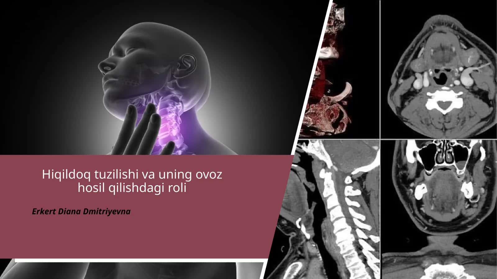 Hiqildoq tuzilishi va ovoz hosil qilish (1-qism) 1
