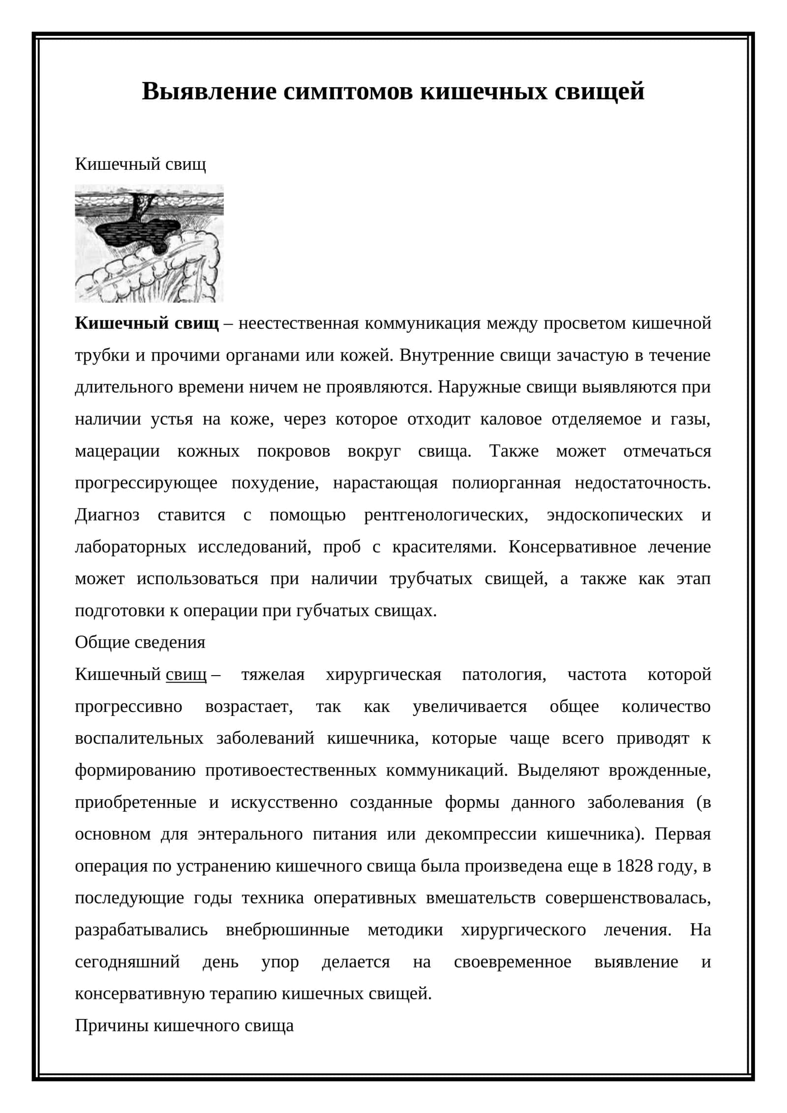 Кишечный свищ 1