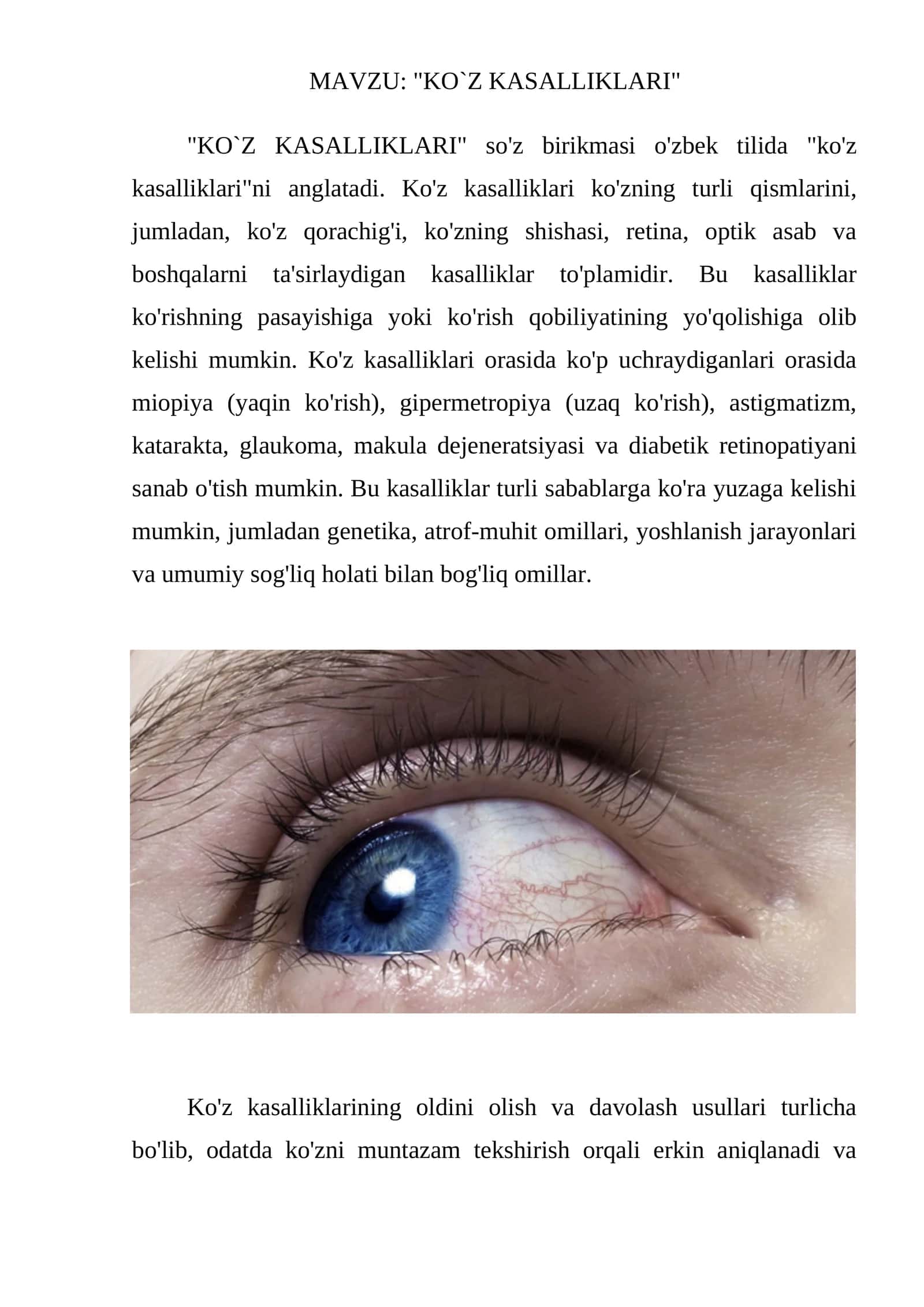 KO`Z KASALLIKLARI 1