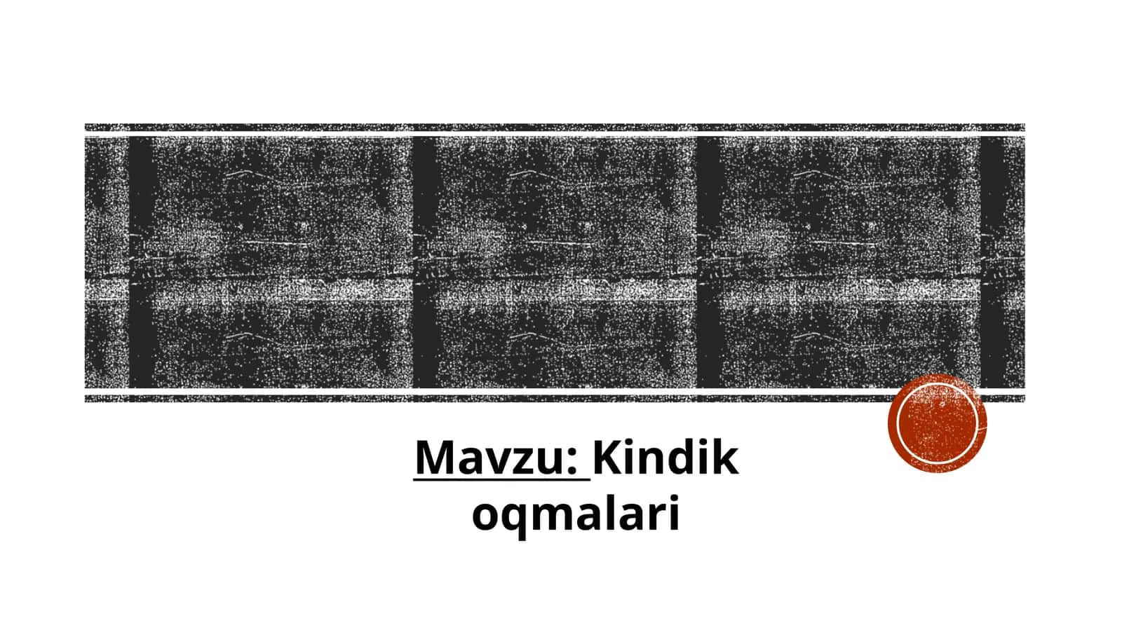 Kindik oqmalari 1