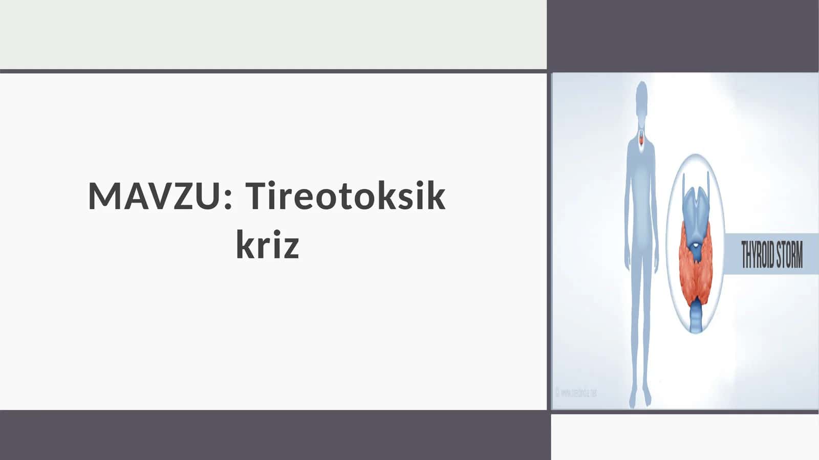 Tireotoksikkriz 1