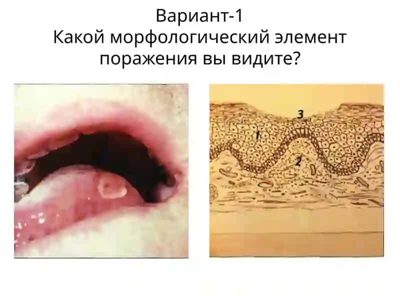 Вариант-1