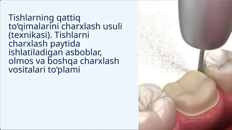 Tishlarning qattiq to‘qimalarini charхlash usuli (tехnikasi). Tishlarni charхlash paytida ishlatiladigan asboblar, olmos va boshqa charхlash vositalari to‘plami 1