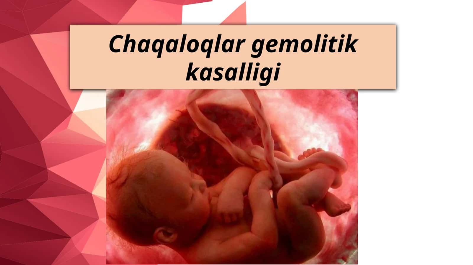 Chaqaloqlar gemolitik kasalligi 1