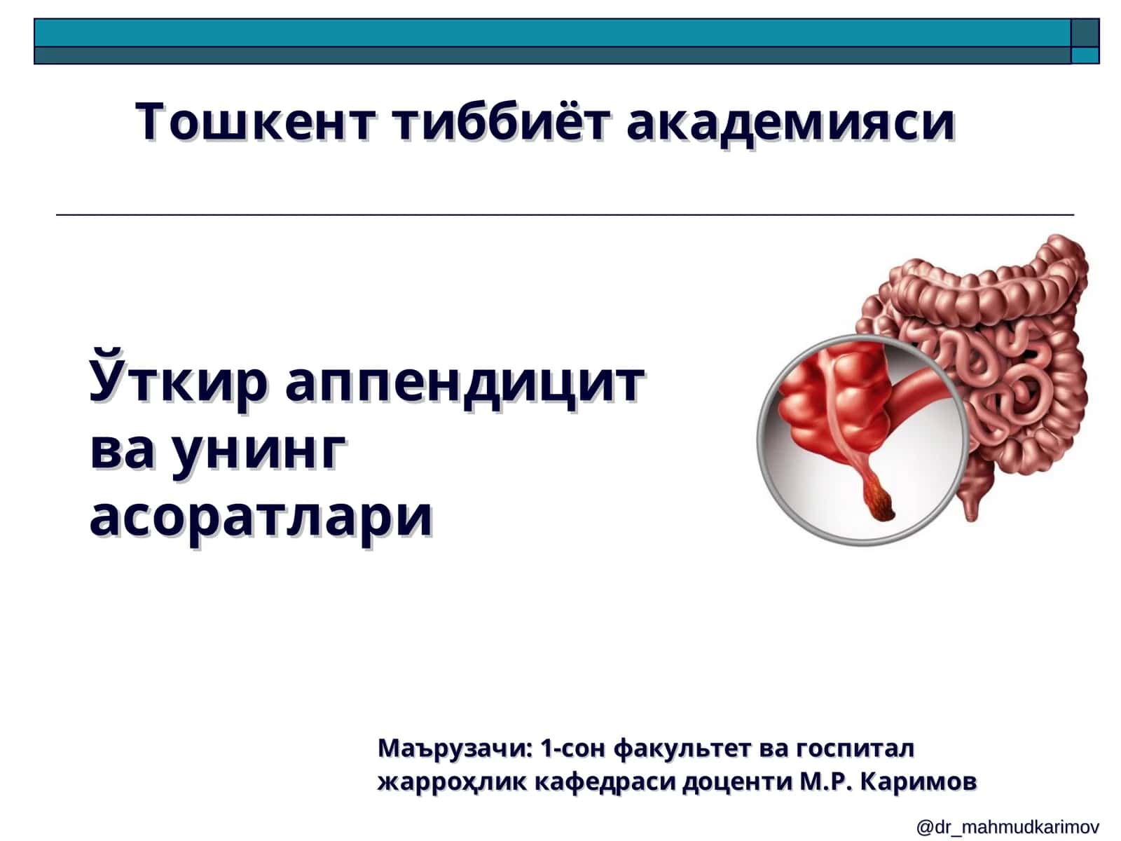 Ўткир аппендицит ва унинг асоратлари 1