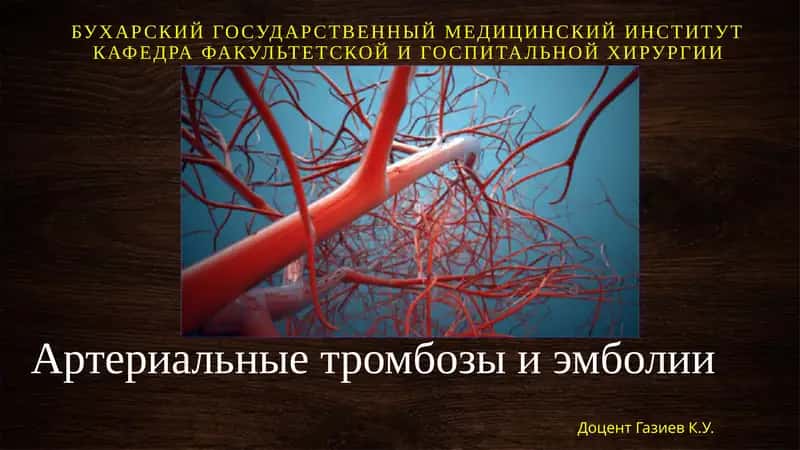 Артериальные тромбозы и эмболии 1