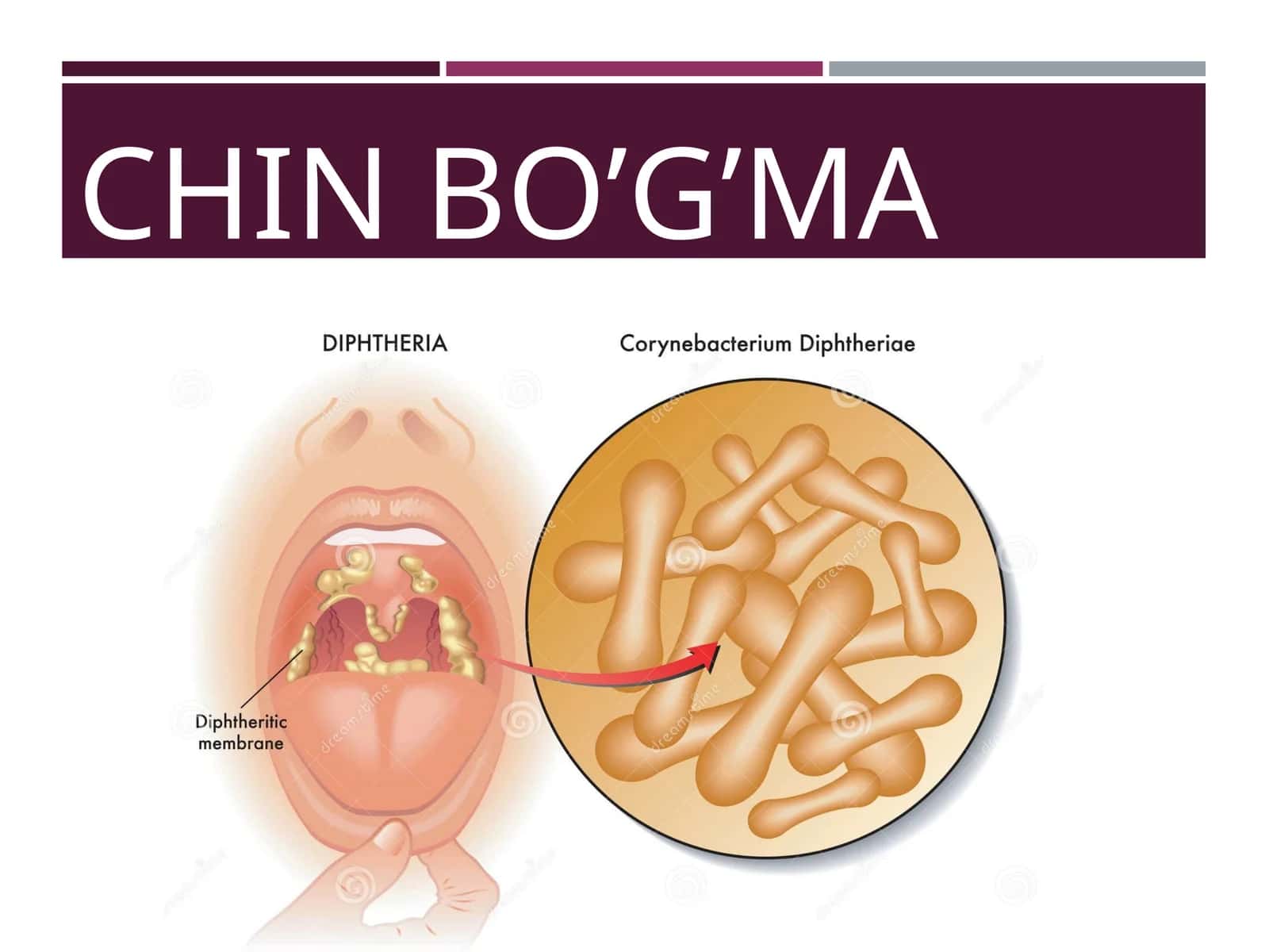 CHIN BO’G’MA 1