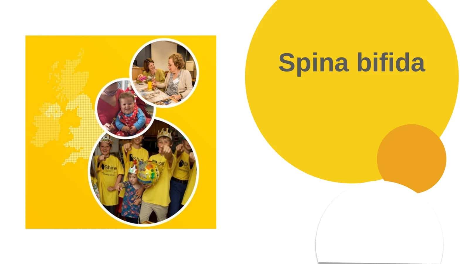 Spinabifida 1