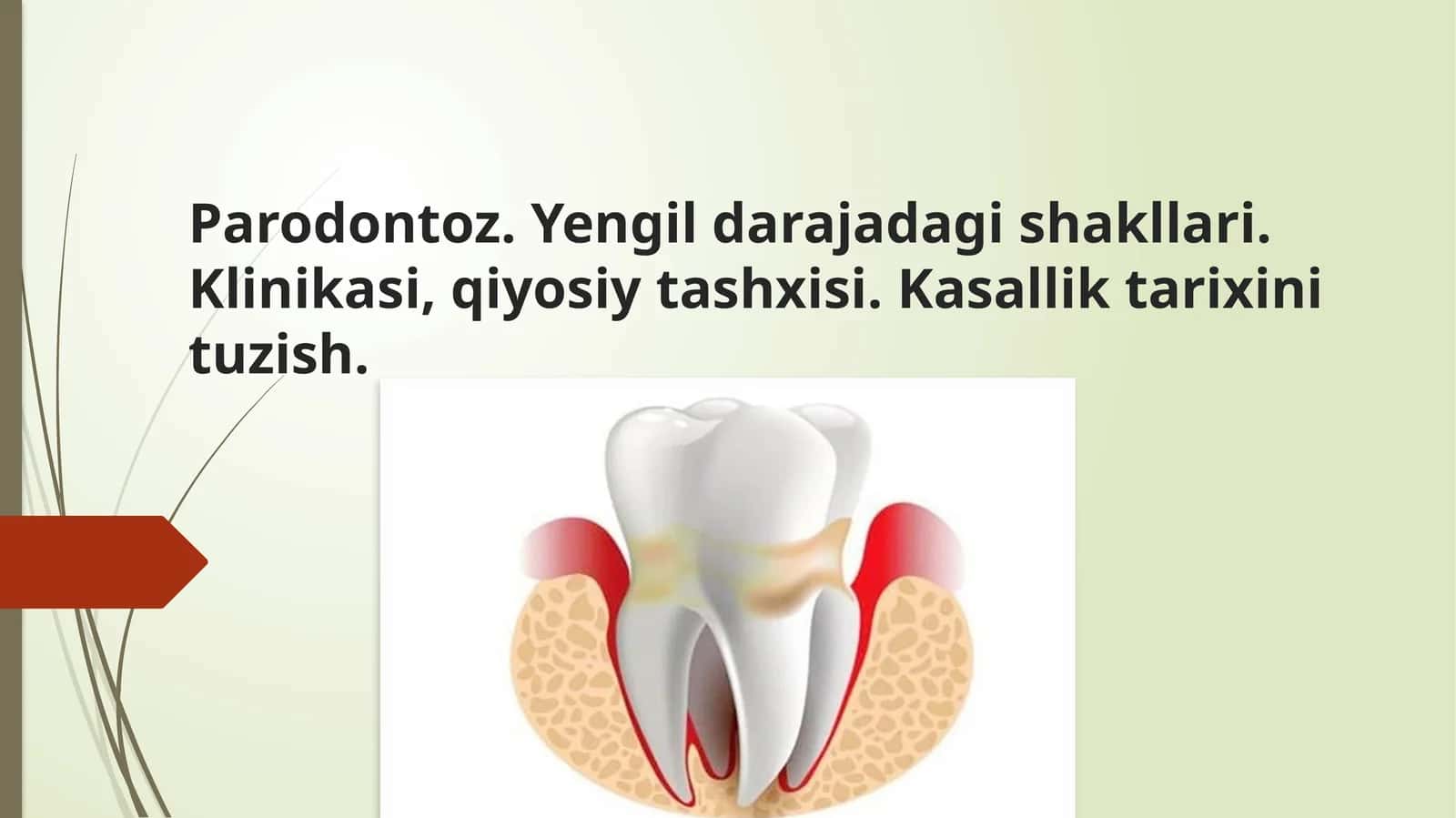 Parodontoz. Yengil darajadagi shakllari. Klinikasi, qiyosiy tashxisi. Kasallik tarixini tuzish 1