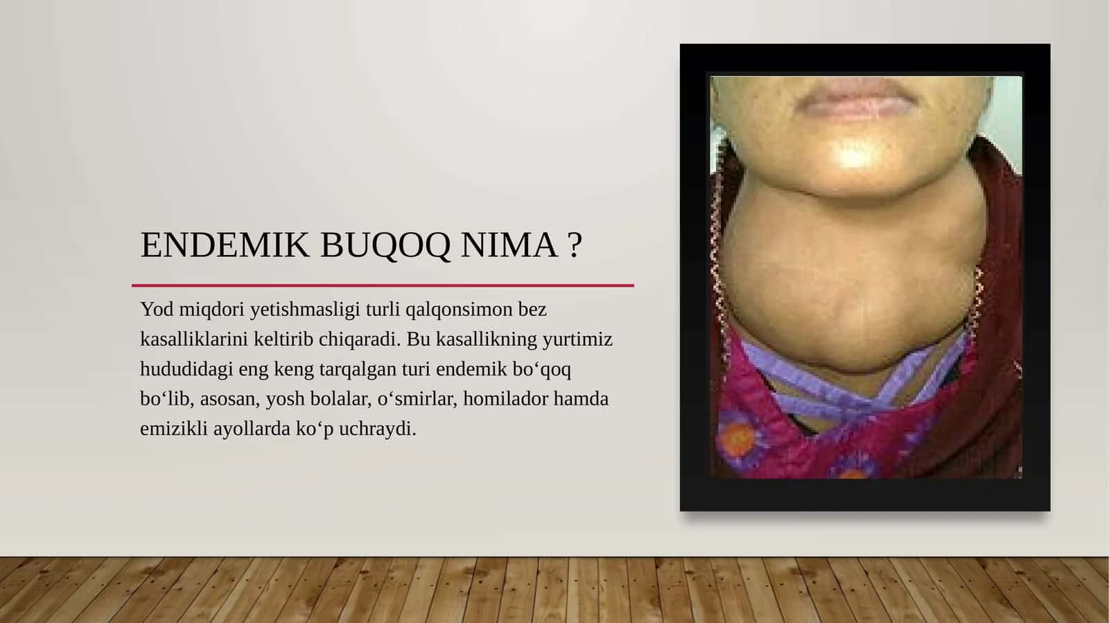 Endemik buqoq biokimyo 13-mavzu 1