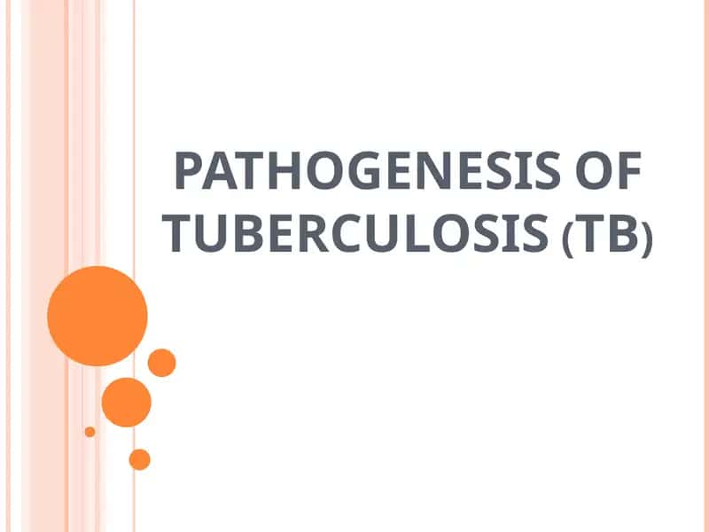 Pathogenesis of Tuberculosis (TB) 1