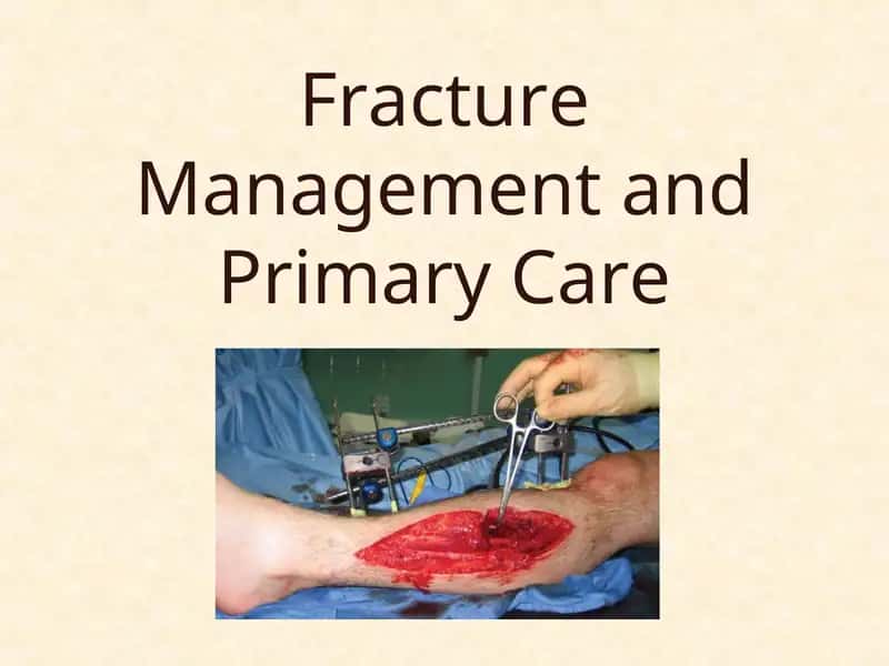 Fracture Management and Primary Care 1