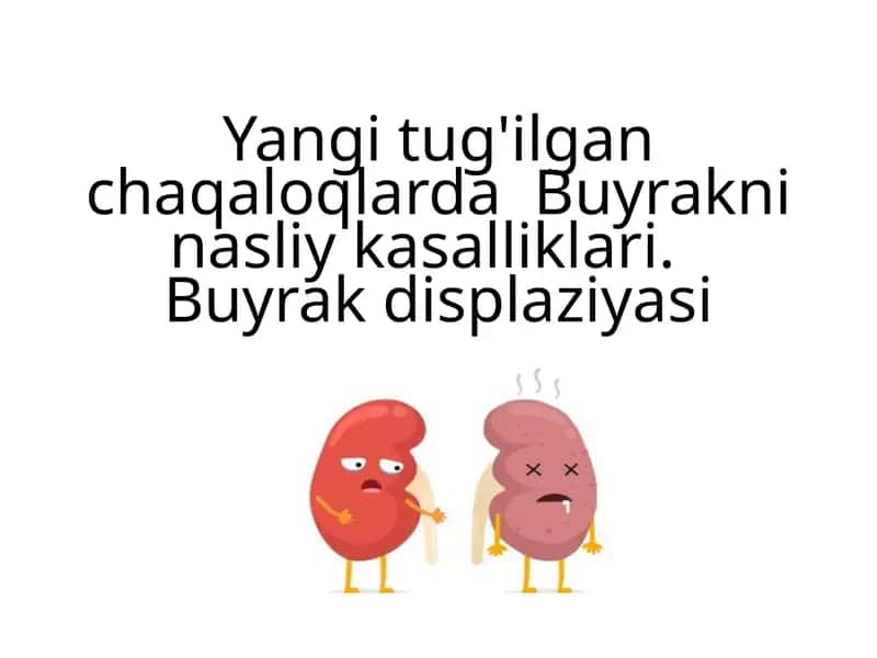 Buyrakni nasliy kasalliklari.Buyrak displaziyasi 1