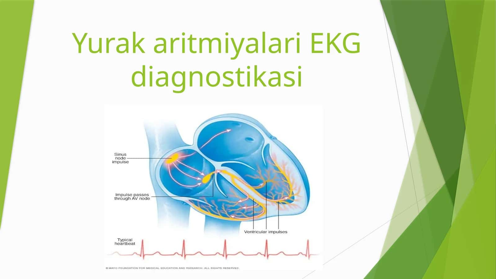 Yurak aritmiyalari EKG diagnostikasi 1