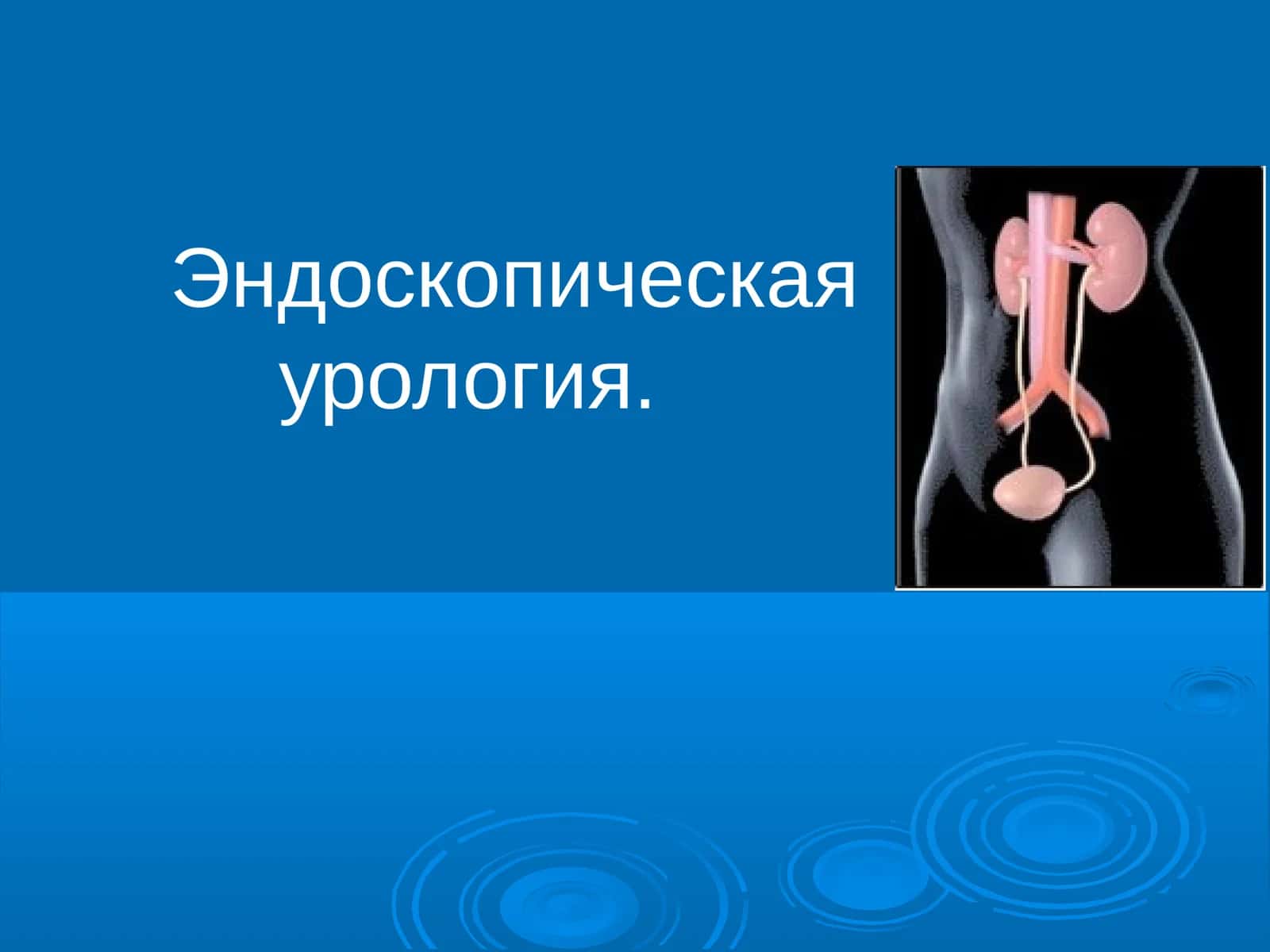 Эндоскопическая урология. Инструментальная урология 1